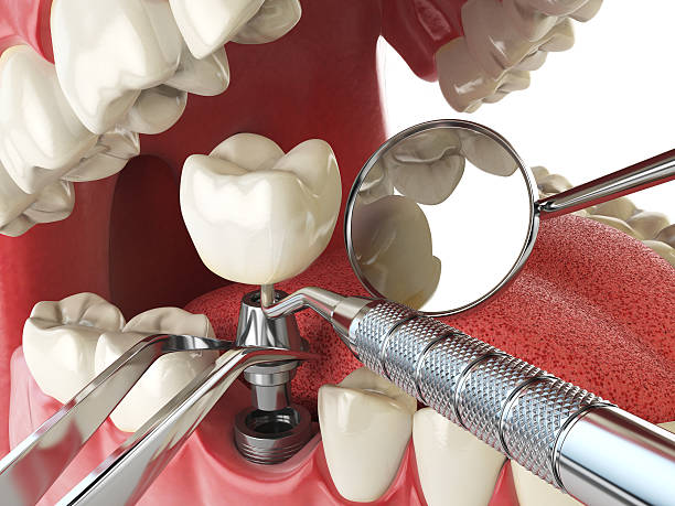 Best Emergency Treatment for Jaw Pain or Injury in Dearborn, MI